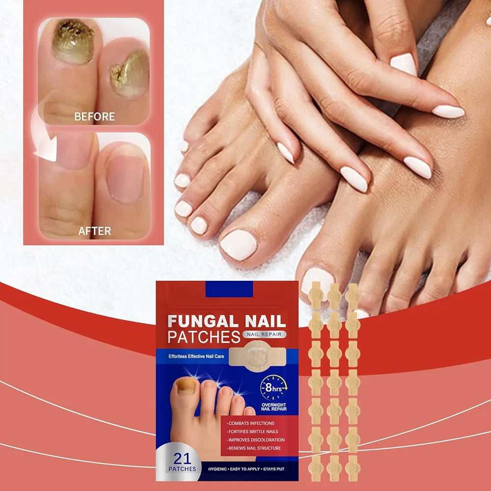 Parches reparadores uñas con hongo